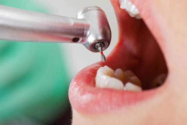 Best Emergency Dentist for Knocked-Out Tooth in Pinewood, FL